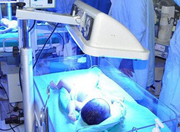 Phương pháp chiếu đèn trị vàng da ở trẻ sơ sinh