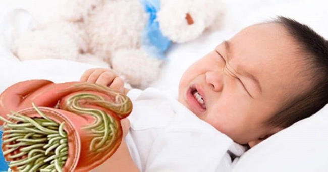 Trẻ bị đau bụng do nhiễm giun
