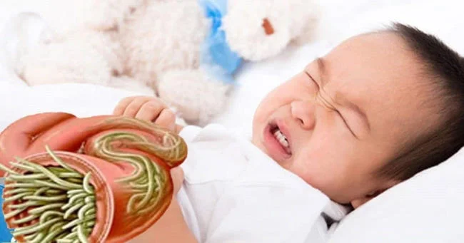 Trẻ bị đau bụng do nhiễm giun