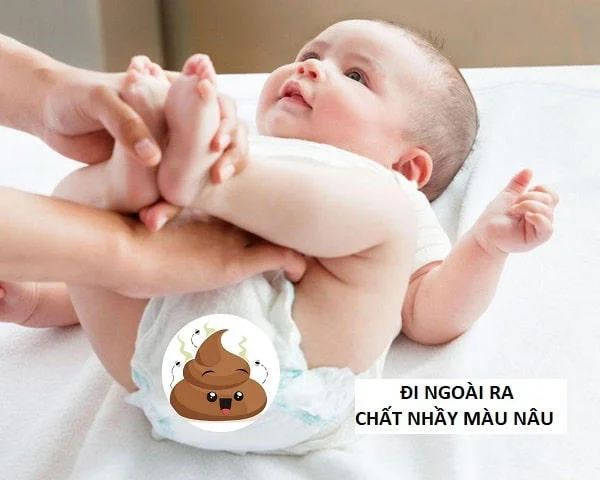 Trẻ đi ngoài có chất nhầy màu nâu “tố cáo” bệnh gì?