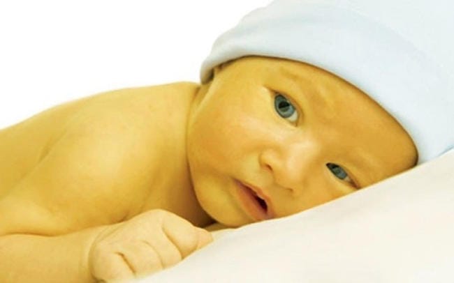 Trẻ sơ sinh 1 tháng tuổi chưa hết vàng da có nguy hiểm không?