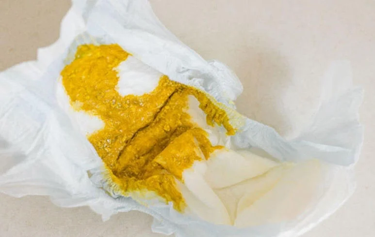 Trẻ sơ sinh đi ngoài phân sống trong những tháng đầu