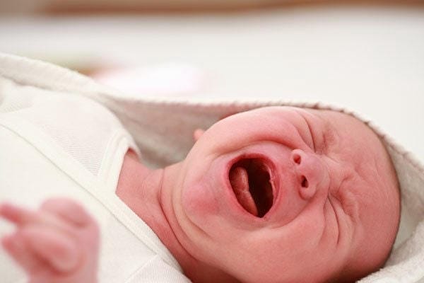 Viêm ruột thừa khiến bé đau bụng dữ dội