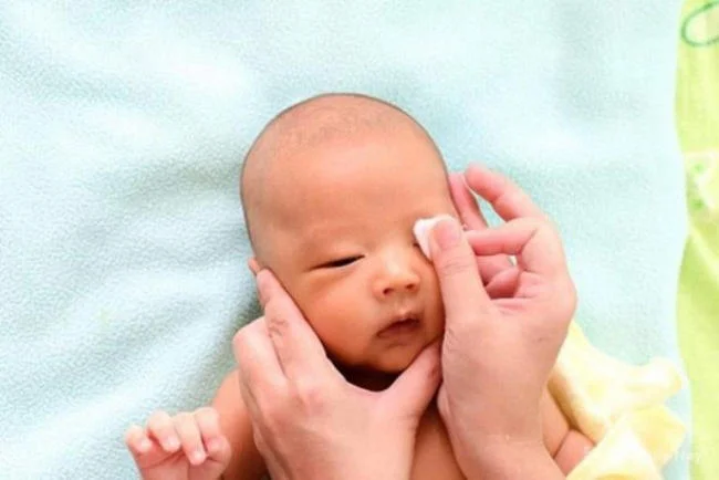 Ngăn ngừa nguy cơ lây nhiễm lẹo mắt