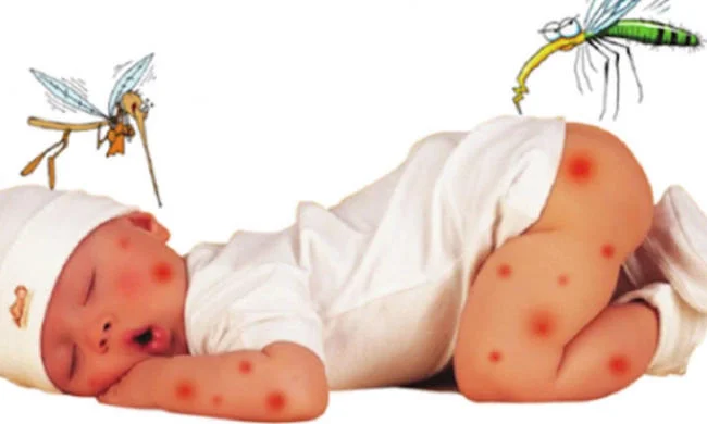 Trẻ bị muỗi đốt