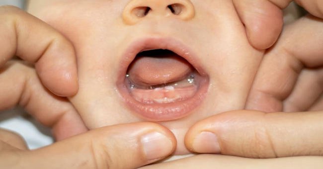 9 dấu hiệu trẻ mọc răng cần nhận biết sớm