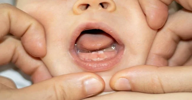 9 dấu hiệu trẻ mọc răng cần nhận biết sớm