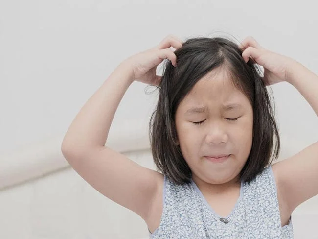 Bé không được vệ sinh da đầu sạch sẽ
