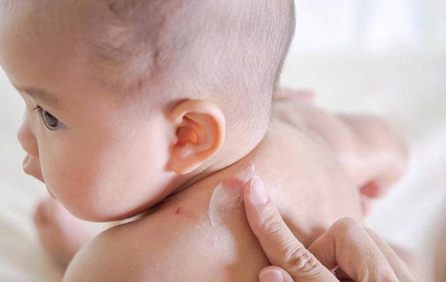 Bé tắm quá nhiều khiến da khô