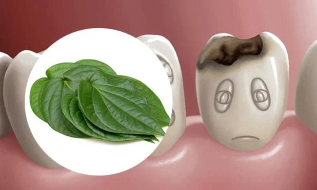 Cách trị sâu răng cho bé bằng lá trầu không