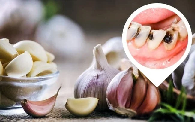 Cách trị sâu răng cho trẻ tại nhà bằng tỏi