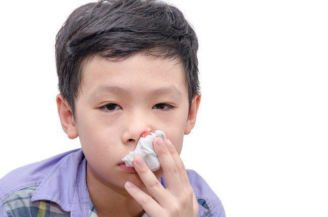 Chảy máu mũi trước là hiện tượng phổ biến ở trẻ em và dễ nhận biết