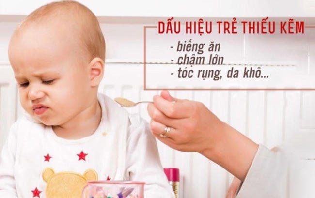 Dấu hiệu nhận biết thiếu kẽm ở trẻ