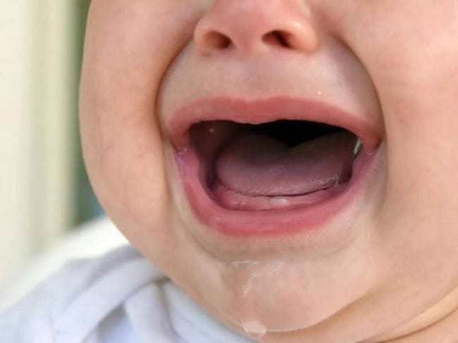 Dấu hiệu trẻ mọc răng sớm