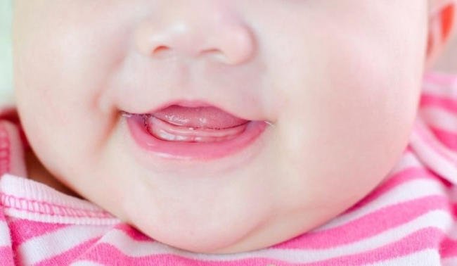 Hình ảnh lợi trẻ sắp mọc răng của trẻ em mọi lứa tuổi là gì?