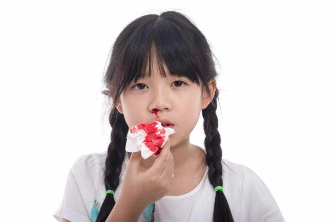 Rối loạn đông máu cũng có thể là nguyên nhân chảy máu cam ở trẻ em