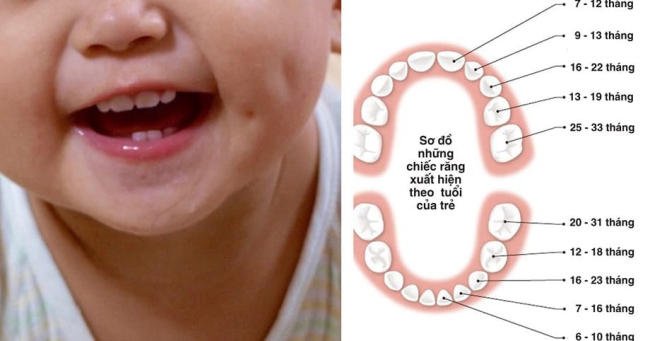 Thứ tự mọc răng của bé