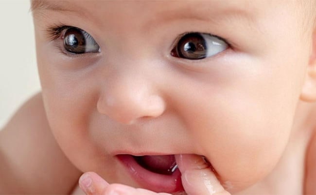 Trẻ chậm mọc răng có thể liên quan đến yếu tố di truyền
