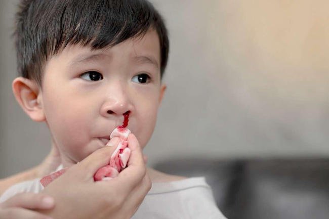 Trẻ em chảy máu cam có nguy hiểm không?