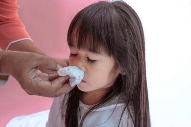 Trẻ em thường bị chảy máu mũi trước với một lượng không nhiều