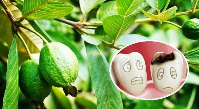 Trị sâu răng cho bé bằng lá ổi