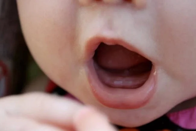 Bé 9 tháng chưa mọc răng chưa được coi là muộn