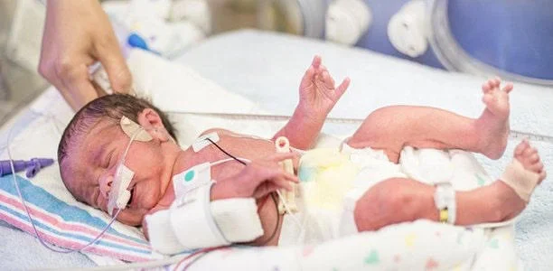 Bé sinh non, thiếu tháng thường mọc răng muộn