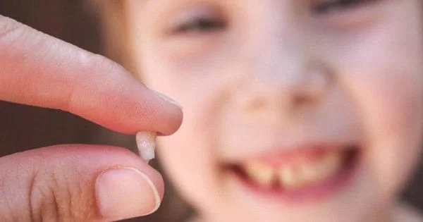 Dấu hiệu răng sữa sắp rụng
