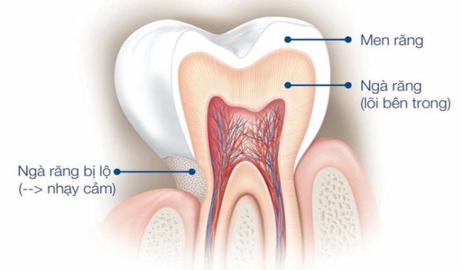 Kiểm tra tính nhạy cảm của răng