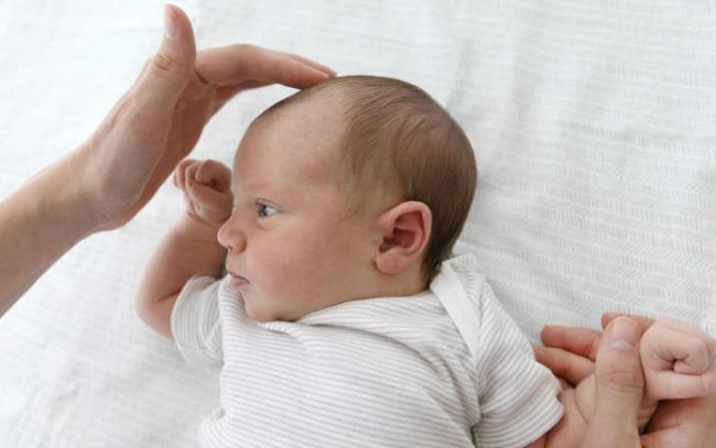 Thóp trẻ sơ sinh như thế nào là bình thường 1