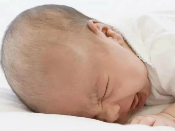 Thóp trẻ sơ sinh như thế nào là bình thường 2