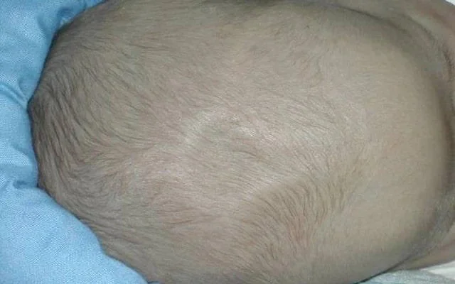 Thóp trẻ sơ sinh như thế nào là bình thường 3