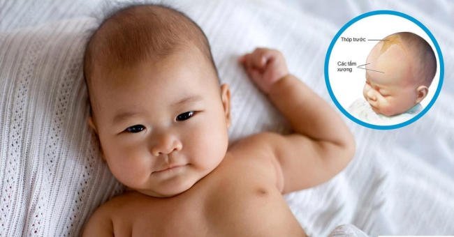 thóp trẻ sơ sinh