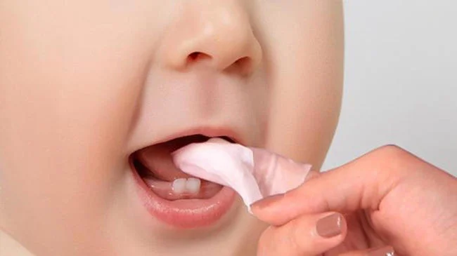 Xử lý nấm miệng cho trẻ bằng phương pháp hiện đại