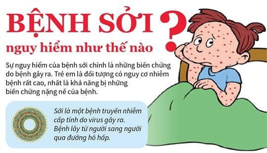 nhung nguy co tiem an khi tre mac benh soi