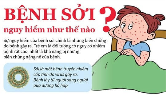 Triệu chứng bệnh sởi ở trẻ em như thế nào cần đưa đến bệnh viện