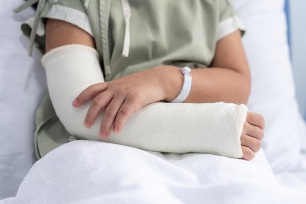 Trẻ Bị Gãy Tay Bó Bột Trong Bao Lâu? Bao Lâu Thì Tháo Được?