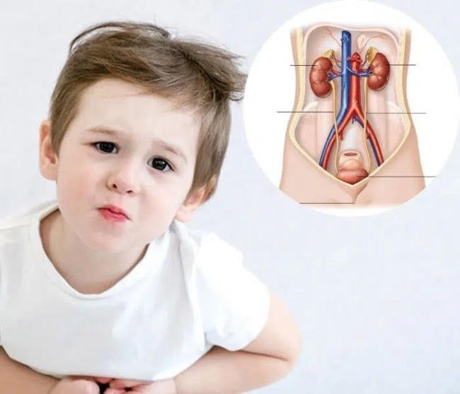 Trẻ bị đái dắt do bệnh lý