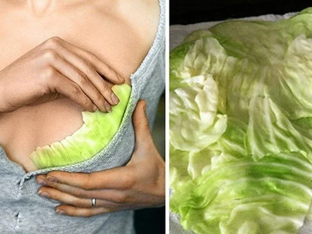 Đắp lá cải là mẹo dân gian chữa căng sữa