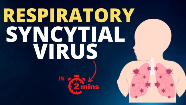 virus hợp bào hô hấp